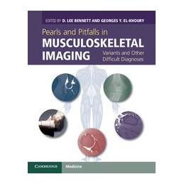 Pearls and Pitfalls in Musculoskeletal Imaging: Variants and Other Difficult Diagnoses