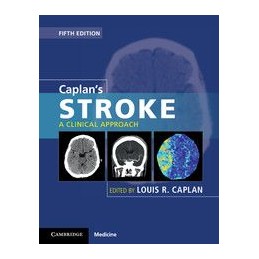 Caplan's Stroke: A Clinical...