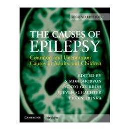 The Causes of Epilepsy:...