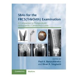 SBAs for the FRCS(Tr&Orth) Examination: A Companion to Postgraduate Orthopaedics Candidate's Guide
