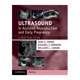 Ultrasound in Assisted...