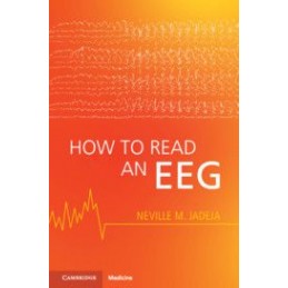 How to Read an EEG