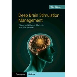 Deep Brain Stimulation...
