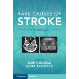 Rare Causes of Stroke: A Handbook