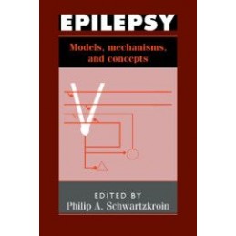 Epilepsy: Models,...