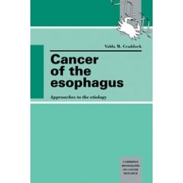 Cancer of the Esophagus:...