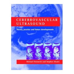 Cerebrovascular Ultrasound:...