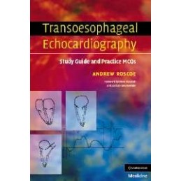 Transoesophageal Echocardiography: Study Guide and Practice MCQs