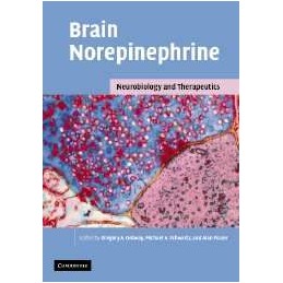 Brain Norepinephrine:...