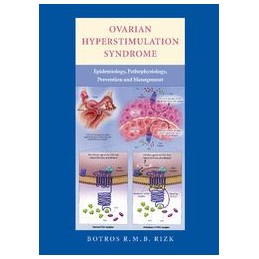 Ovarian Hyperstimulation Syndrome: Epidemiology, Pathophysiology, Prevention and Management