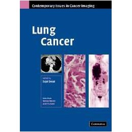 Lung Cancer