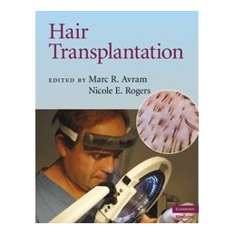 Hair Transplantation