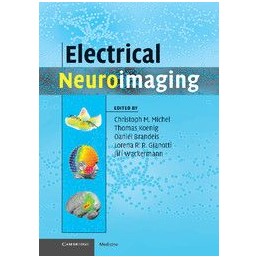 Electrical Neuroimaging