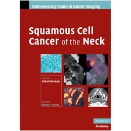 Squamous Cell Cancer of the...