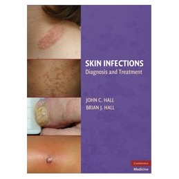 Skin Infections: Diagnosis and Treatment