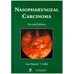 Nasopharyngeal Carcinoma