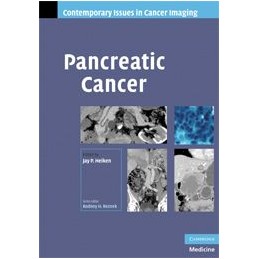 Pancreatic Cancer