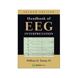 Handbook of EEG Interpretation