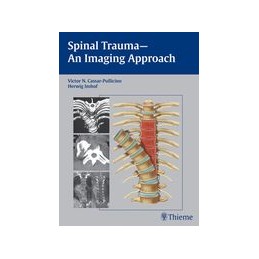 Spinal Trauma - An Imaging Approach