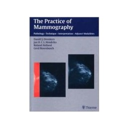 Practice of Mammography