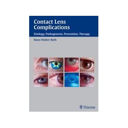 Contact Lens Complications