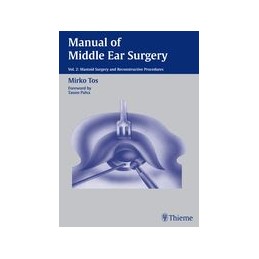 Manual ofMiddle Ear Surgery, Volume 2