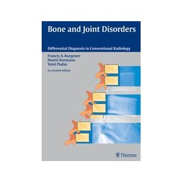 Bone and Joint Disorders