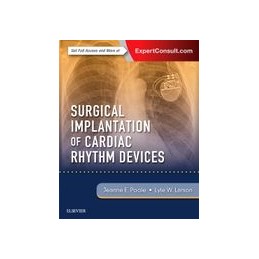 Surgical Implantation of...