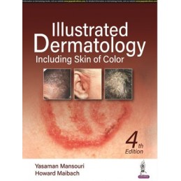 Illustrated Dermatology:...