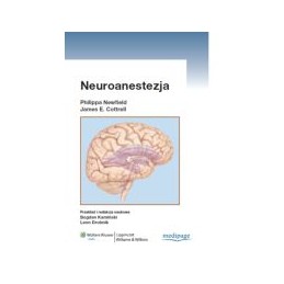 Neuroanestezja
