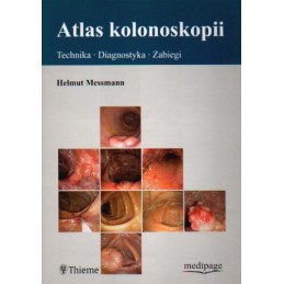 Atlas kolonoskopii