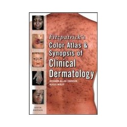 Fitzpatrick's Color Atlas and Synopsis of Clinical Dermatology 6e