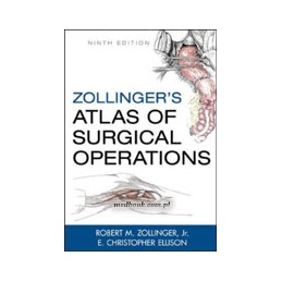 Zollinger's Atlas of Surgical Operations, Ninth Edition