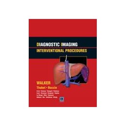 Diagnostic Imaging: Interventional Procedures