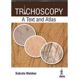 Trichoscopy: A Text and Atlas