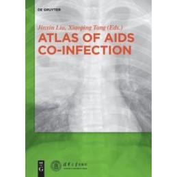 Atlas of AIDS Co-infection