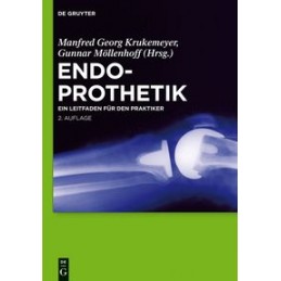 Endoprothetik: Ein Leitfaden für den Praktiker