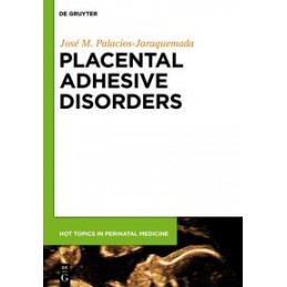 Placental Adhesive Disorders