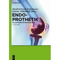 Endoprothetik: Ein Leitfaden für den Praktiker