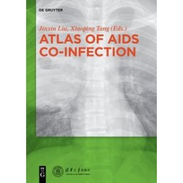 Atlas of AIDS Co-infection