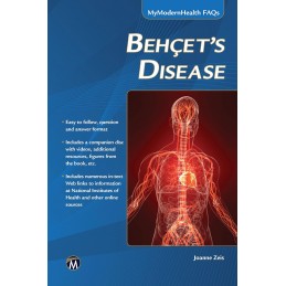 Behcet's Disease