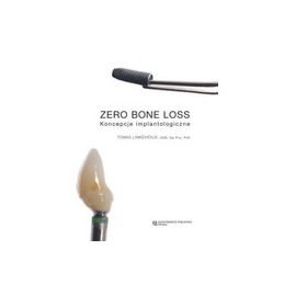 Zero bone loss - koncepcje implantologiczne