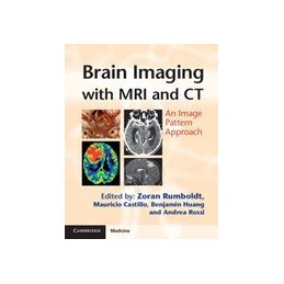Brain Imaging with MRI and...