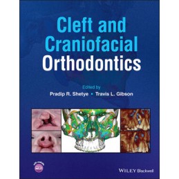 Cleft and Craniofacial...