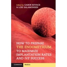 How to Prepare the...
