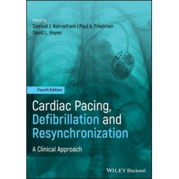 Cardiac Pacing,...