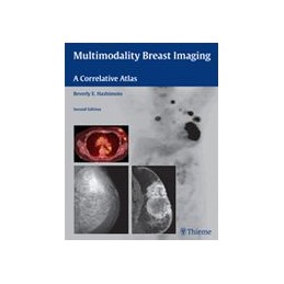 Multimodality Breast...