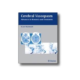 Cerebral Vasospasm