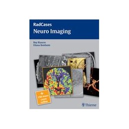 Radcases Neuro Imaging