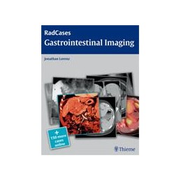 Radcases Gastrointestinal Imaging